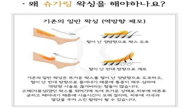 슈가링 왁싱 필요성